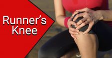 Runner’s Knee Syndrome